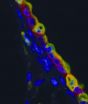 New insights on control of pituitary hormone outside of brain has implications for breast cancer