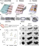 New microfluidic device reveals how the shape of a tumour can predict a cancer’s aggressiveness