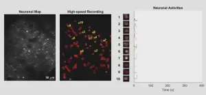 New microscope offers faster, high-resolution brain imaging