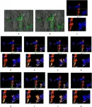 New motion blur restoration approach for improved weed detection in crop fields