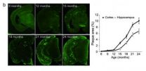 New mouse model could revolutionize research in Alzheimers disease