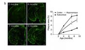 New mouse model could revolutionize research in Alzheimer's disease 2