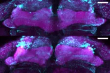 New mutation linked to early-onset Parkinsonism