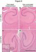 New non-invasive technique controls size of molecules penetrating the blood-brain barrier