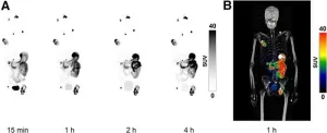 New PET agent provides exceptional same-day imaging for clear cell renal cell carcinoma patients