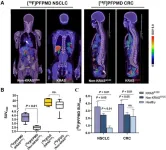 New PET tracer noninvasively identifies cancer gene mutation, allows for more precise diagnosis and therapy