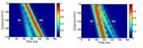 New progress in long bone fracture evaluation using ultrasound