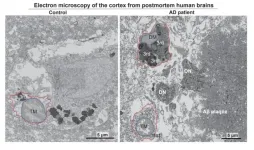 New research identifies key cellular mechanism driving Alzheimer’s disease