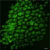 New shrinking gel steers tooth tissue formation 2