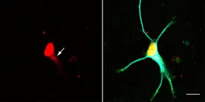 New signaling pathway in neurons