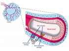 New strategy to attack tumor-feeding blood vessels