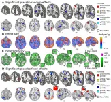 New study gives the most detailed look yet at the neuroscience of placebo effects