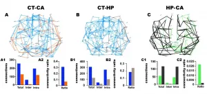 New study identifies plasticity disparities between patients with brain malformation