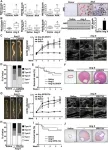 New study sheds light on the role of Wnt/β-catenin signaling in abdominal aortic aneurysm