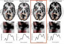 New super-resolution technique allows for more detailed brain imaging