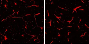 New technique allows researchers to dig into molecular causes of pediatric bipolar disorder