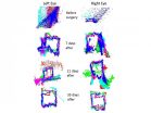 New technology advances eye tracking as biomarker for brain function and brain injury