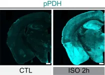 New technology lets researchers track brain cells’ “off switches”