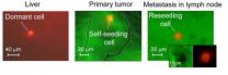 New technology using florescent proteins tracks cancer cells circulating in the blood 2