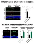 New treatment developed to dramatically slow down the progression of blindness-causing retinal diseases 2