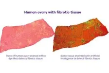 New treatment extends ovarian function in older mice 2