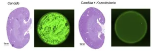 Newly identified yeast could prevent fungal infections by outcompeting rivals, study suggests