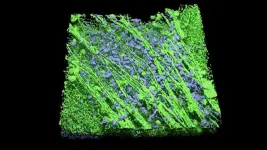 NIH awards $2.7 million to map retinal connections in degenerative eye disease