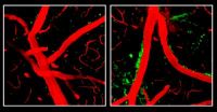 NIH-funded research provides new clues on how ApoE4 affects Alzheimers risk