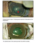 NIH-led studies point to potential development of a cataract drug