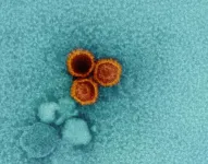 NIH scientists find weak points on Epstein-Barr virus