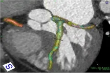 No-Cath forecast