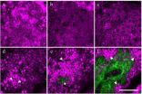 No more lying about your age: Scientists can now gauge skins true age with new laser technique