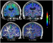 Normal ageing might be associated with increased blood-brain barrier permeability in regions also vulnerable in Alzheimers Disease, in small study comparing healthy brains of the young and old