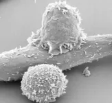 Nourishing T cells to fight cancer 2