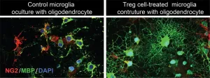 Novel immunotherapy boosts long-term stroke recovery in mice