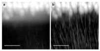 Novel microscopy method offers sharper view of brains neural network