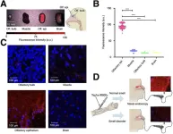 Novel molecular imaging tool objectively measures and diagnoses smell disorders