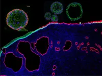 Novel organoid models: Illuminating path to cervical cancers