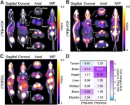 Novel PET tracer maps fructose metabolism to identify cardiac and neural disorders