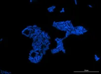 Novel sensor discovered that helps bacteria detect and respond to formaldehyde