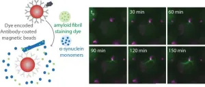 Novel test holds promise for detecting Parkinson’s disease early