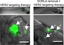 Novel therapy-resistance mechanism promoting the growth of breast cancer brain metastasis