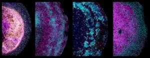 Novel tissue-derived brain organoids could revolutionize brain research 3