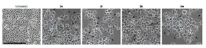 Novel tridimensional anticancer agents developed to fight against drug-resistant cancer cells 3