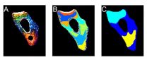 Now researchers can see how unfolded proteins move in the cell