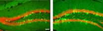 Nurturing newborn neurons sharpens minds in mice