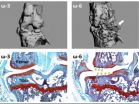 Omega 3 fatty acids lessen severity of osteoarthritis in mice