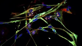 Once rhabdomyosarcoma, now muscle