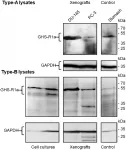 Oncotarget: A ghrelin receptor inverse agonist for positron emission tomography