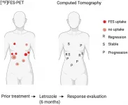 Oncotarget: Anti-hormonal treatment eligibility in granulosa cell tumors of the ovary